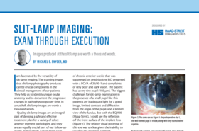 HS_imaging_st_xxx_exam_through_execution.pdf