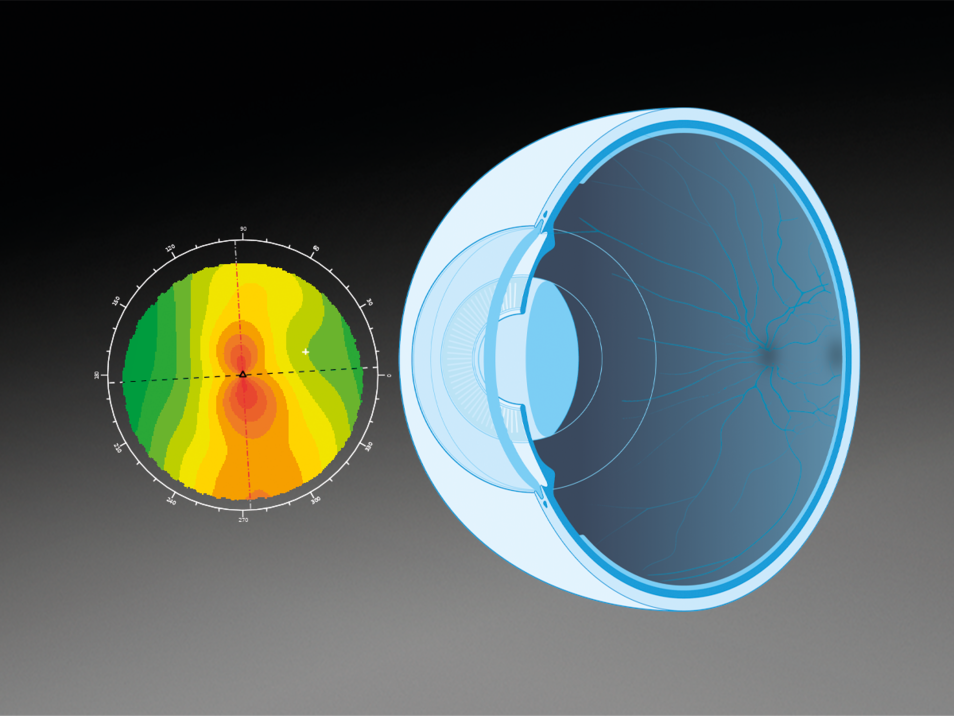 Biometry